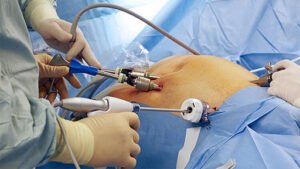 Laparoscopic Surgeon Kanpur