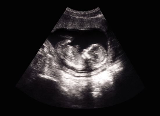 Ultrasound And Imaging